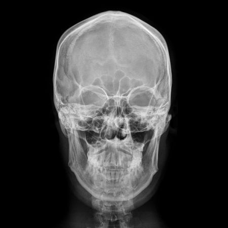 第二張正規專輯「UPSET」(韓國進口版)